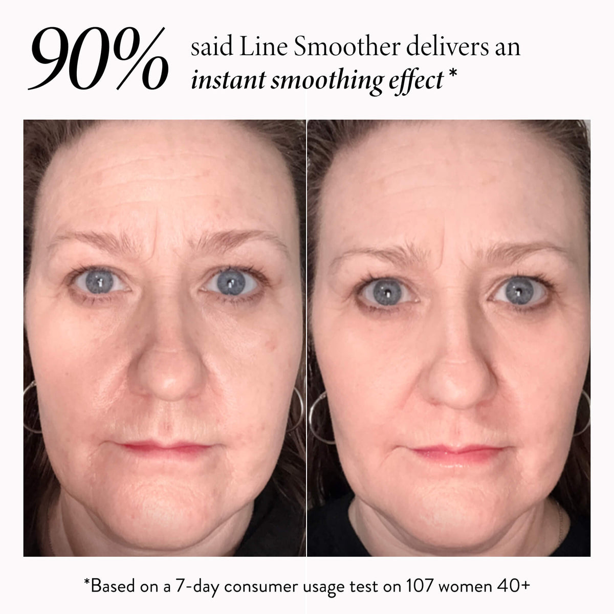 Line Smoother Full Face Kit (3PC)